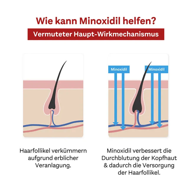 Doppelherz Pharma Minxidil Men 50 mg/ml 3 Months