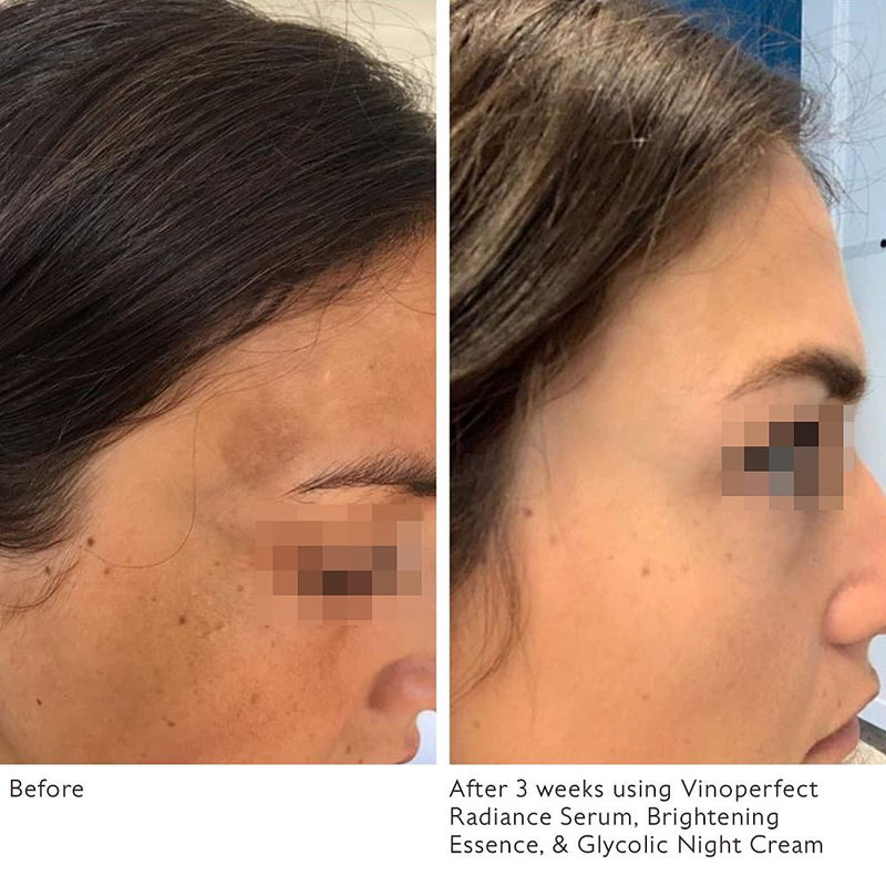 حميل الصورة في عارض المعرض ، كودالي سيروم تصحيح تصبغات البشرة 30 مل - CAUDALÍE Vinoperfect Serum 30 ml - GermanVit - Saudi arabia
