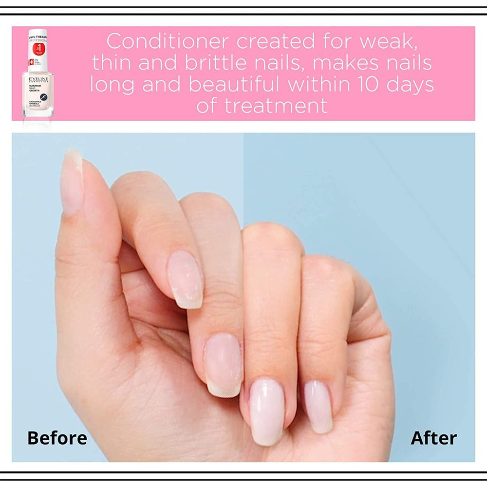 إيفيلين معالج لنمو الأظافر 12 مل - Eveline Cosmetics Maximum Nails Growth 12 ml - GermanVit - Saudi arabia